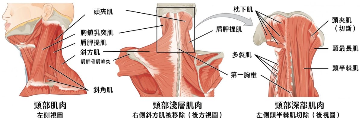 你的颈痛，可能是一场三个肌肉嫌疑犯策划的“完美犯罪”