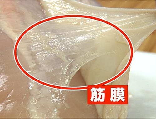 为什么你的“老毛病”总好不了？真相：你可能在“筋膜链上打了个结”